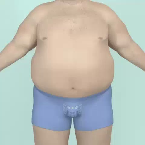 Vidéo